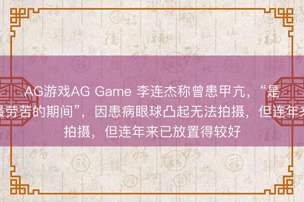 AG游戏AG Game 李连杰称曾患甲亢,“是东说念主生中最劳苦的期间”,因患病眼球凸起无法拍摄,但连年来已放置得较好